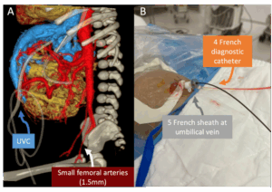 arterial access