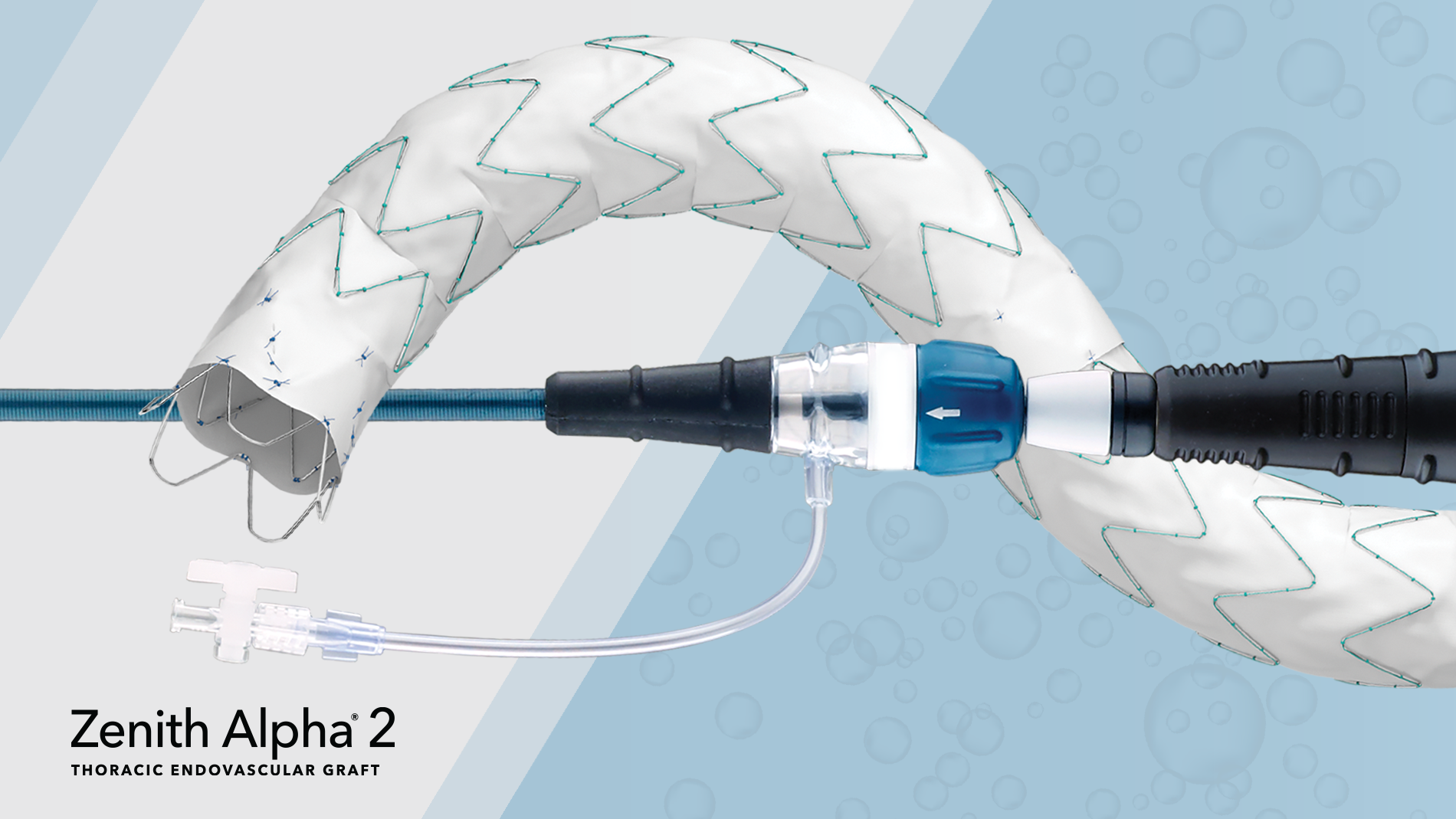 Cook Medical announce first US patient treated with Zenith Alpha 2