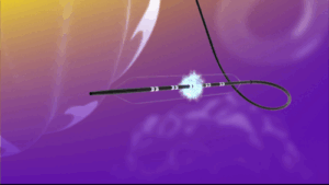 FastWave Medical