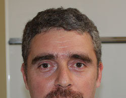 For women, varicocoele embolization represents the most effective and least invasive treatment