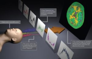New magnetic resonance imaging method fingerprints tissues and diseases