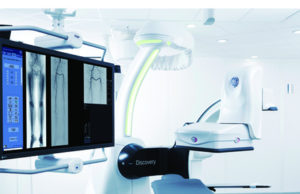 US FDA clearance for Discovery IGS 740 mobile angiography system