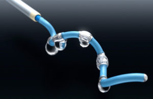 Renlane renal denervation system gets CE mark