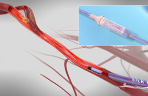 US FDA clears Enroute transcarotid neuroprotection system