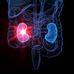ablation-of-small-renal-cancer-associated-with-significantly-lower-costs-than-either-partial-or-radical-nephrectomy