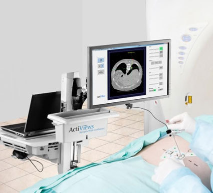 CT-Guide Needle Guidance System for liver interventions gets FDA clearance
