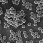 sarah-study-enroling-patients-throughout-france-for-the-treatment-of-primary-liver-cancer