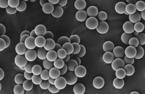 SARAH study enroling patients throughout France for the treatment of primary liver cancer