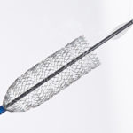 veniti-announces-1000th-patient-treated-with-vici-venous-stent