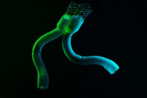 Altura-stent-graft-photo-with-color-1024x684