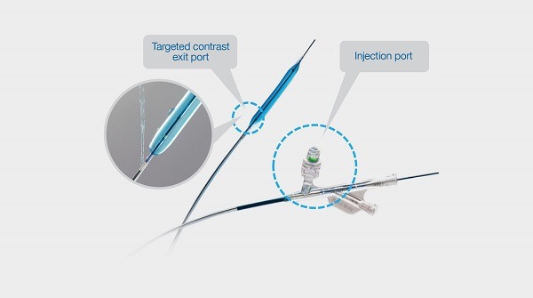 AV Medical Announces Initial US Experience With Chameleon Angioplasty ...