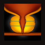 Prostate-MASTER-ORG-STEP-6_web_urolift
