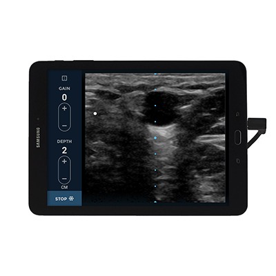 EchoNous Vein receives FDA approval
