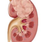 kidney-side-view