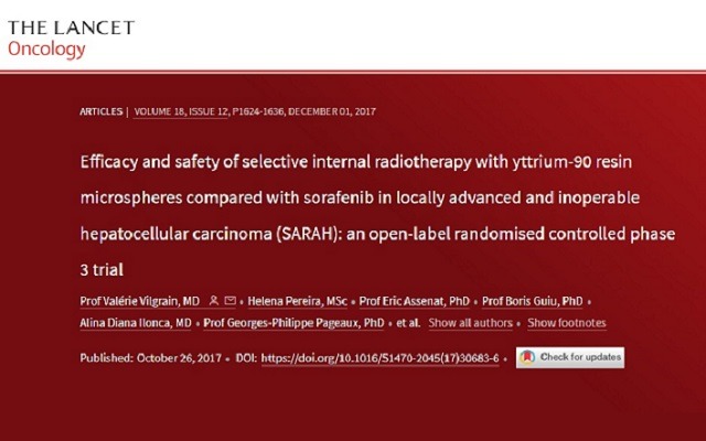 Lessons from randomised controlled trials utilising SIRT in liver cancer