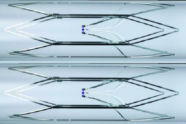 First successful implantation of the bioconvertible Sentry IVC filter