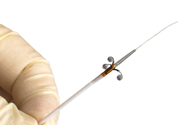 Peregrine catheter demonstrated 100% procedural success in post-market clinical trial