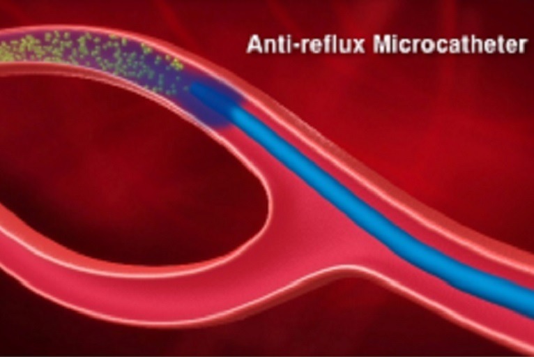 Guerbet receives CE mark approval for SeQure and DraKon microcatheters for interventional imaging