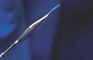 luminal gain achieved by the FLEX VP system alone