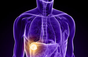 IR provides ‘most efficient’ liver cancer care compared to other specialties, study finds