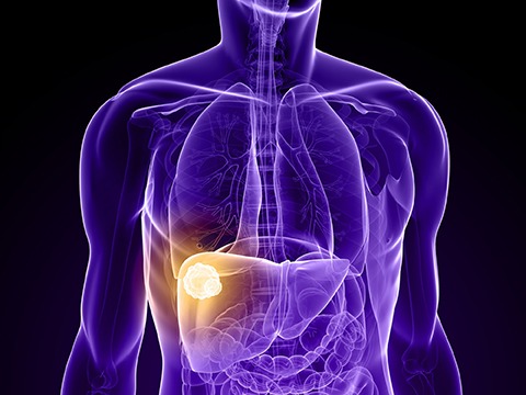IR provides ‘most efficient’ liver cancer care compared to other specialties, study finds
