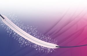 Novel paclitaxel-nano-coated balloon achieves lower incidence of restenosis than plain balloon angioplasty at two years