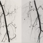 Figure 1 and Figure 2