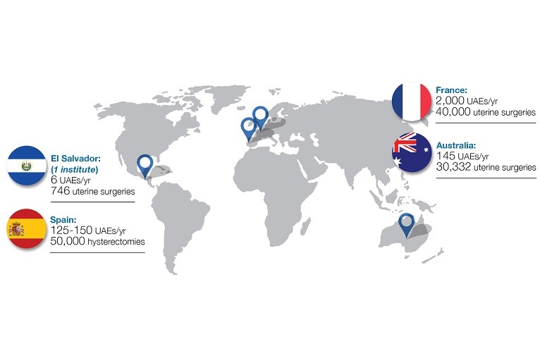 “Huge disparity” between UAE and surgery numbers worldwide