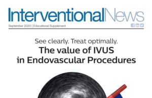 IVUS