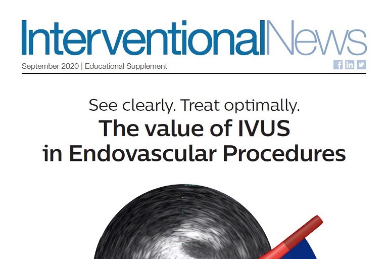 The value of IVUS in endovascular procedures