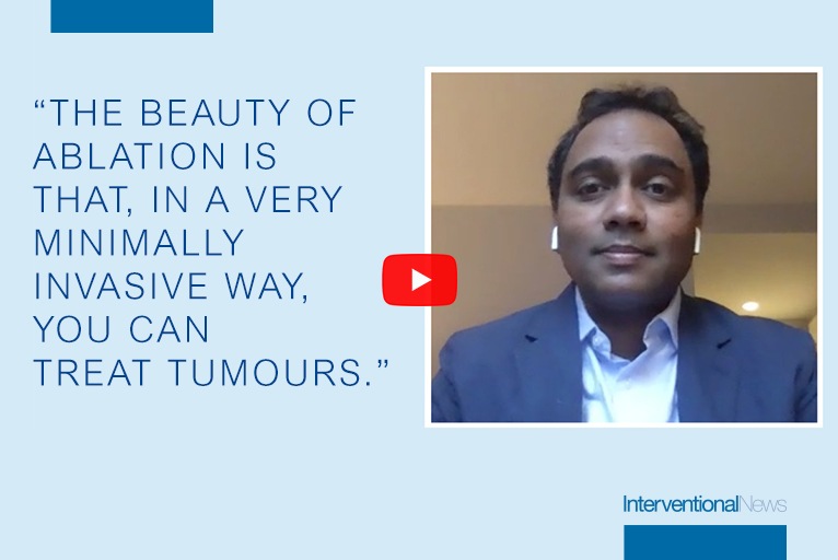 The evolving role of hepatic ablation