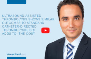 Ultrasound-assisted thrombolysis shows similar outcomes to standard catheter-directed thrombolysis, but adds to the cost