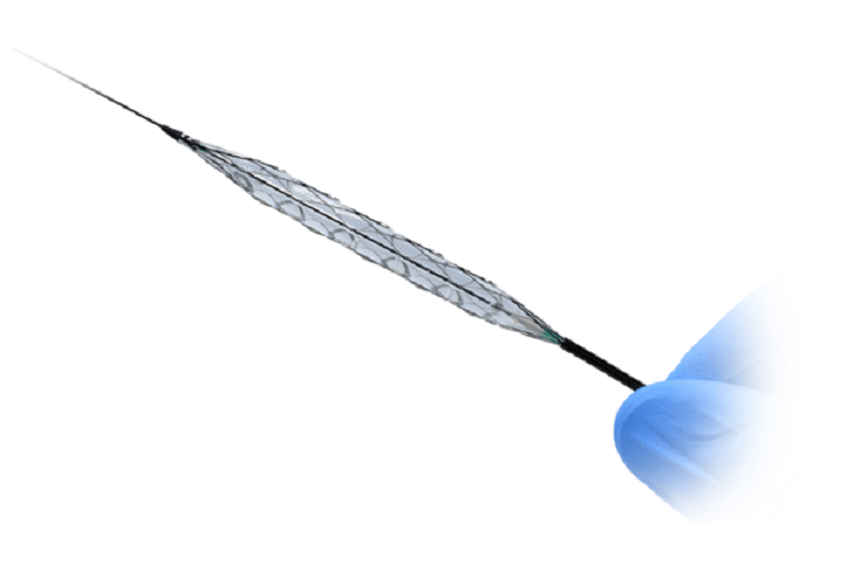 First procedures performed with Transit Scientific’s XO Score angioplasty system