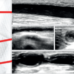 figure1