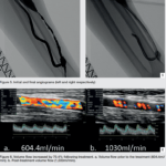 figure6