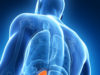 Kidney-sparing embolization reduces patient risks of acute injury and death compared to surgery, study finds kidney embolization