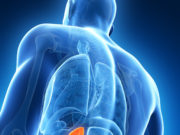 Kidney-sparing embolization reduces patient risks of acute injury and death compared to surgery, study finds kidney embolization