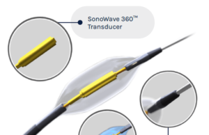 Ultrasound renal denervation meets primary efficacy endpoint in RADIANCE II study