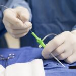 catheter WEB