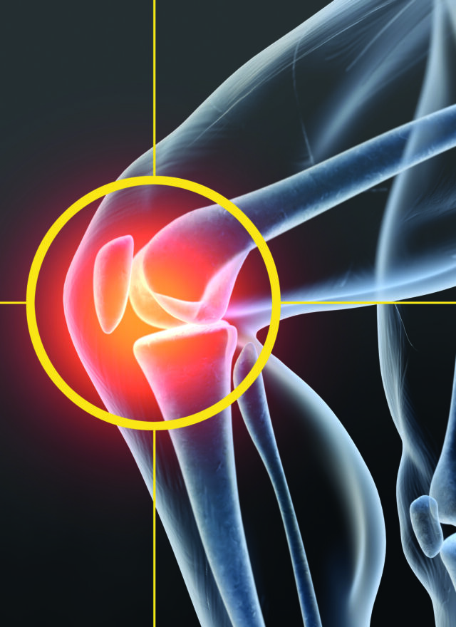 Non-surgical treatment significantly reduces knee pain in adults ...