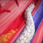 Vein becoming artery with LimFlow crossing stent