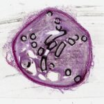 Coil study histologic tissue in resin