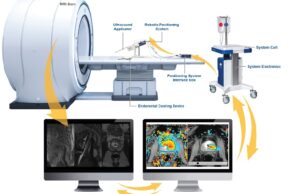Profound Medical announces new CPT category 1 codes for prostate TULSA TULSA