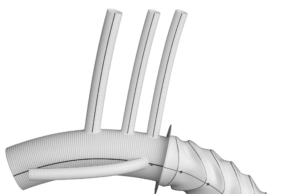 Terumo Aortic announce Thoraflex device approval in Japan