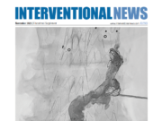 Constant image quality and excellent dose efficiency: OPTIQ and Structure Scout in clinical use