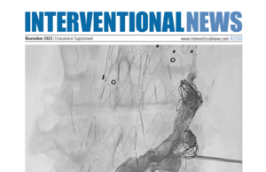 Constant image quality and excellent dose efficiency: OPTIQ and Structure Scout in clinical use