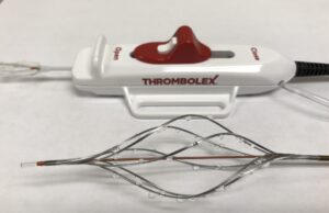 Thrombolex announces new insights from the RESCUE trial with the Bashir endovascular catheter
