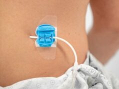 Cook Medical announce partnership with catheter securement device company Bedal International cook medical