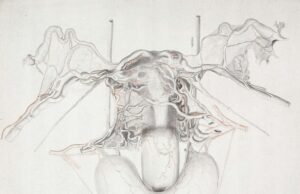 Survey finds women with uterine fibroids offered hysterectomies over minimally invasive treatments uterine fibroids