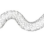 Abre-stent.jpg